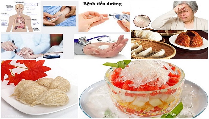 5 Cách Chưng Yến Cho Người Bị Tiểu Đường